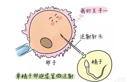 三代试管婴儿技术适用范围包括地中海贫血吗？