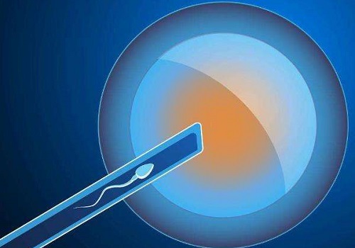 试管婴儿胚胎哪种好？和冻胚的成功率一样吗？
