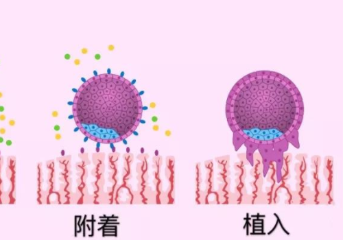 泰国试管医生好不好？