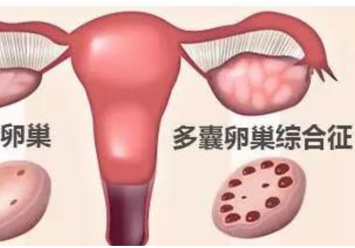 去俄罗斯做试管婴儿多少钱？